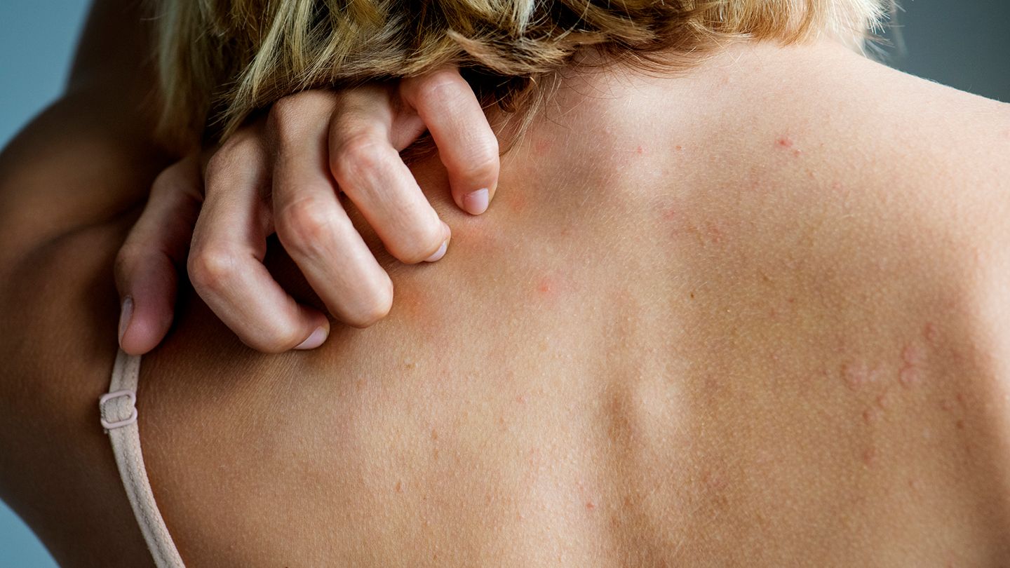 Skin rash : आपकी त्वचा आपके स्वास्थ्य के बारे में क्या कहती है